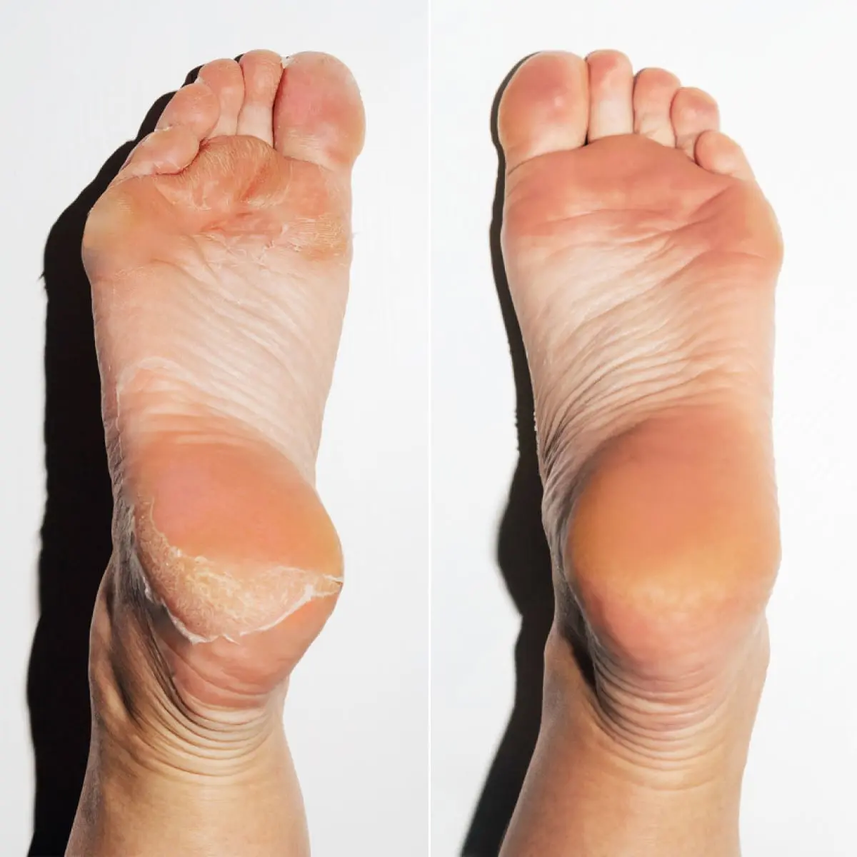 Spa Collection - Image 8